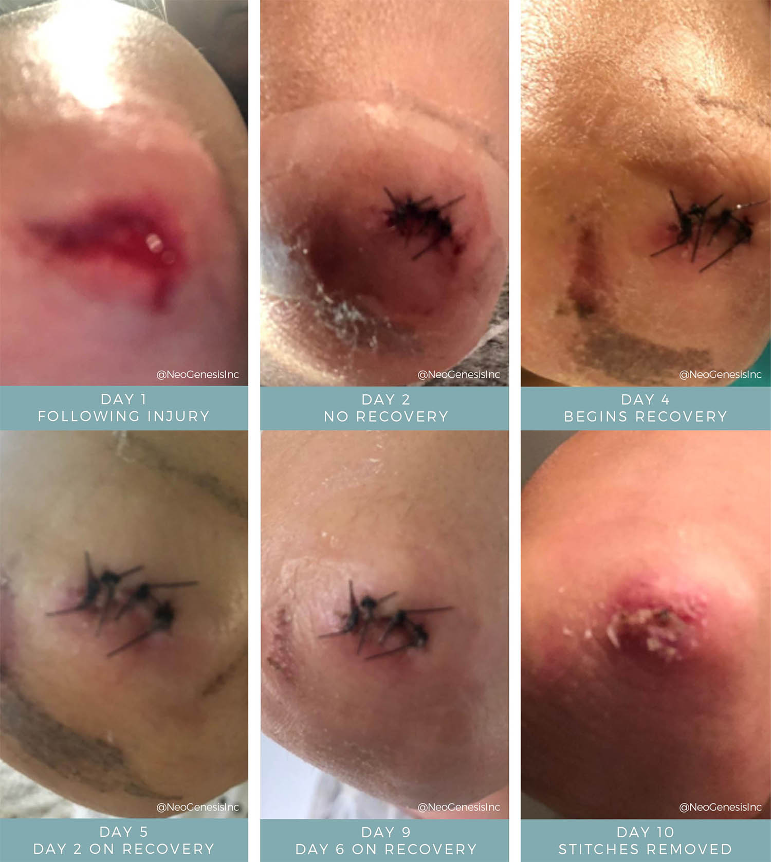 Before + After - Wound Care