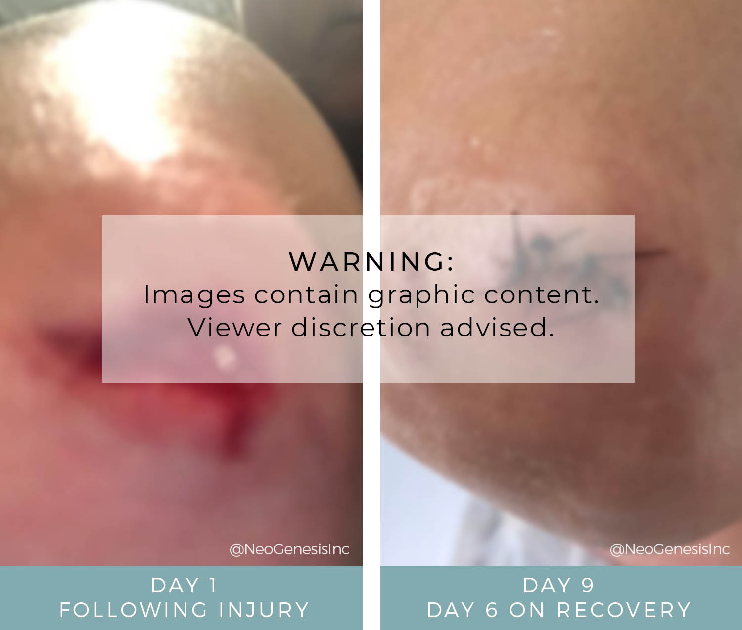 Before + After - Wound Care