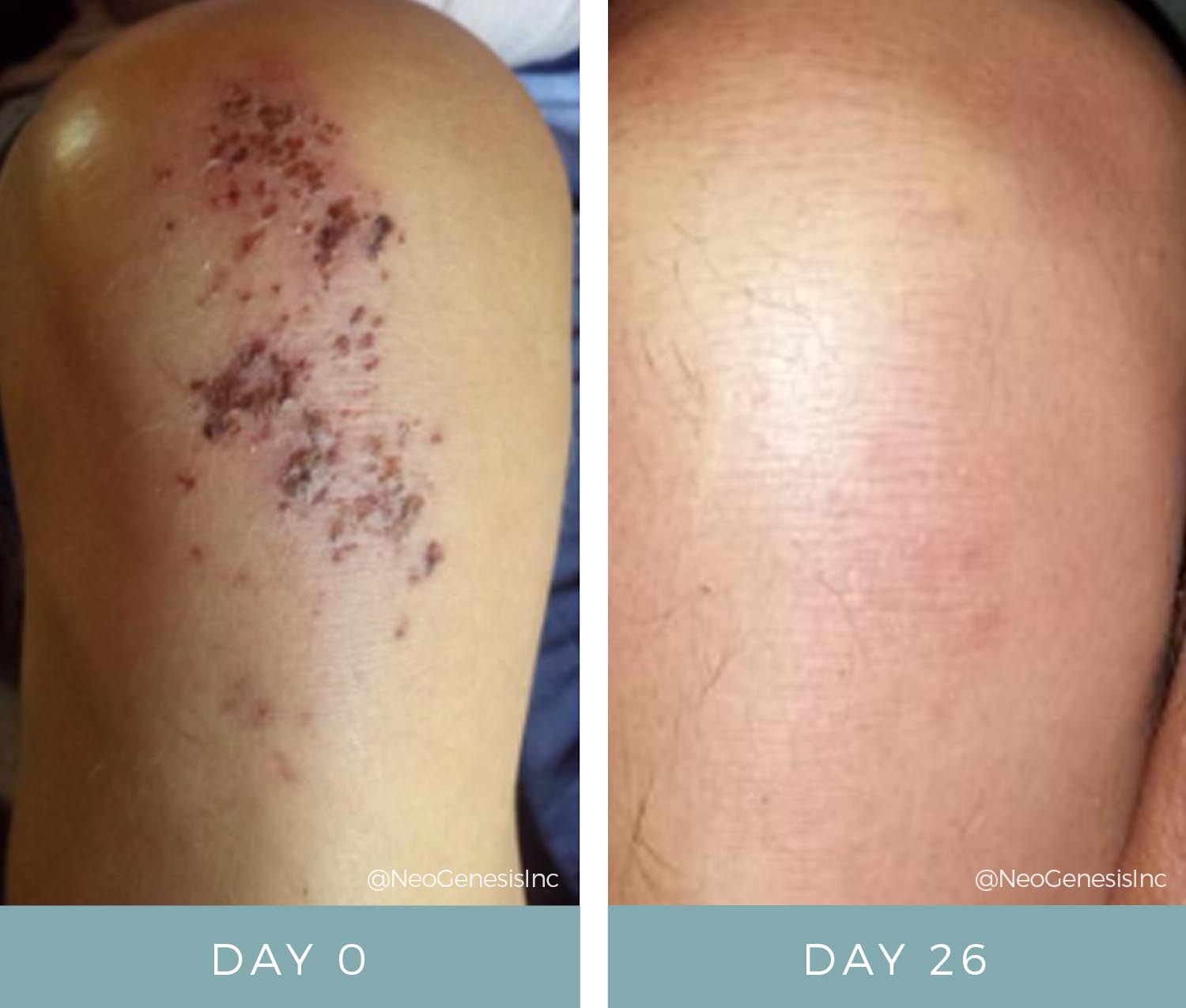 Before + After - Wound Care